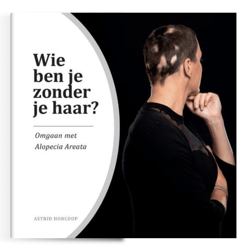Alopecia