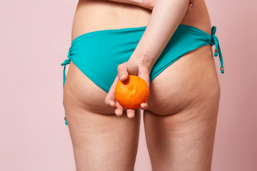 cellulite tips