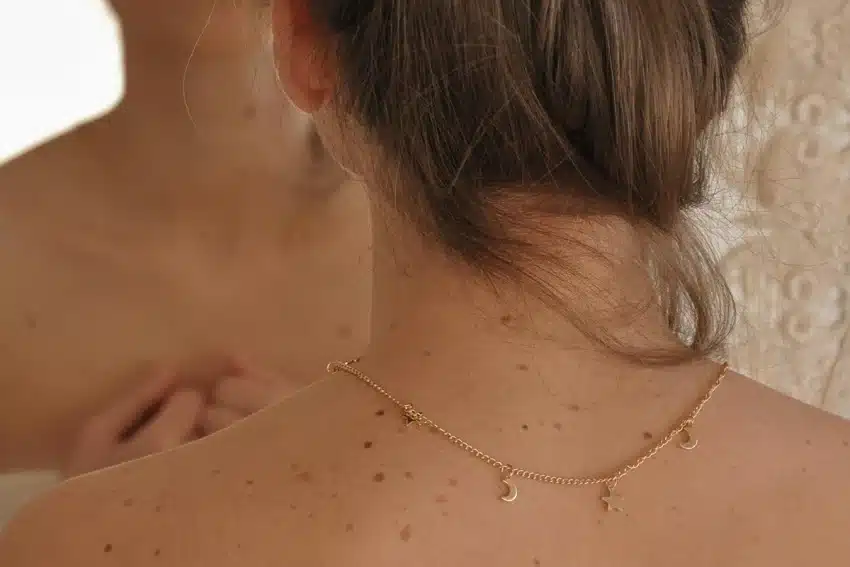 16032026 San Pexels Sunsetoned 6431179